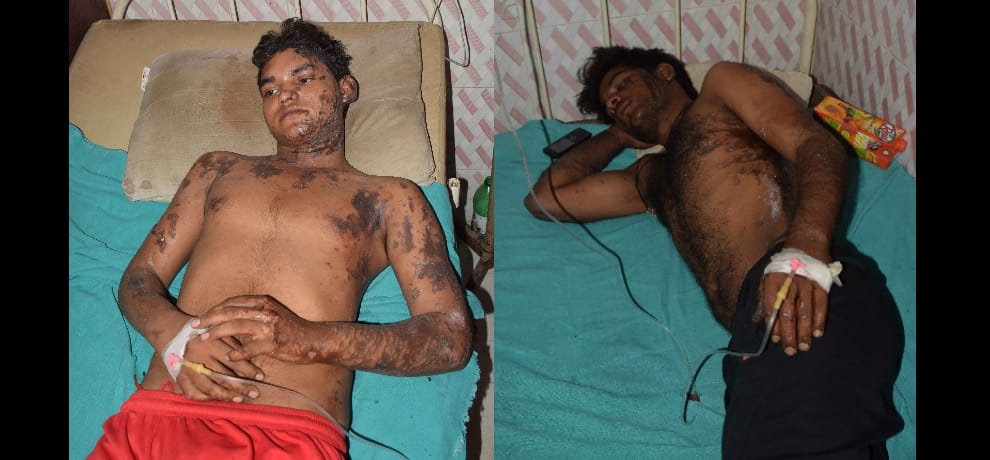 in a road rage canter driver throws acid on six including woman in noida's chotpur village