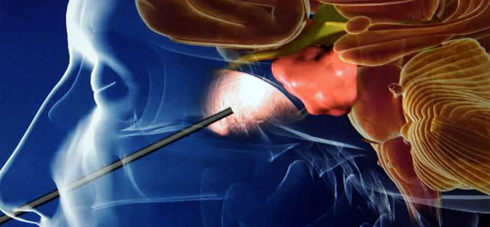 Neurosurgery facility in tanda medical college