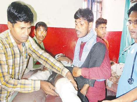 Three Bike rider injured in bus collision