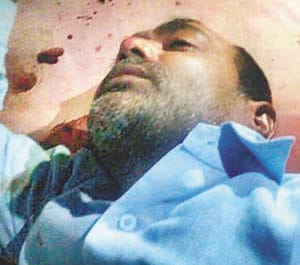 criminal burst fire on salesman of petrol pump, 40000 looted