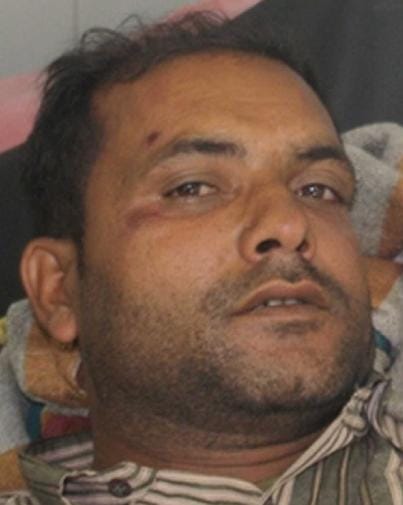 Young man injured in a road accident in Ramnagar