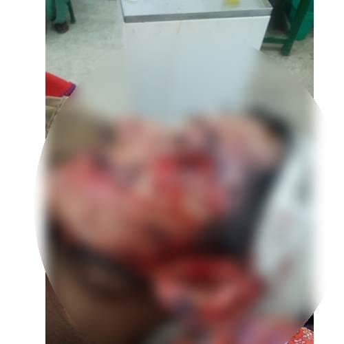 Himachal Pradesh: One killed, 3 hurt in bear attack at Kullu