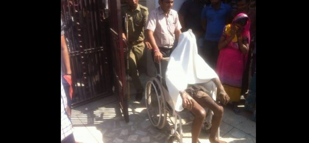 petrol thrown on e-rokshaw driver and set him on fire