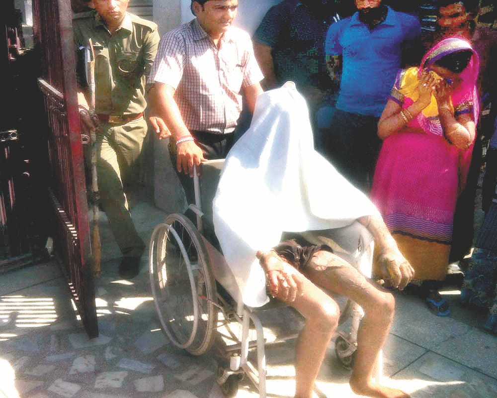 E-rickshaw driver poured petrol on fire, serious