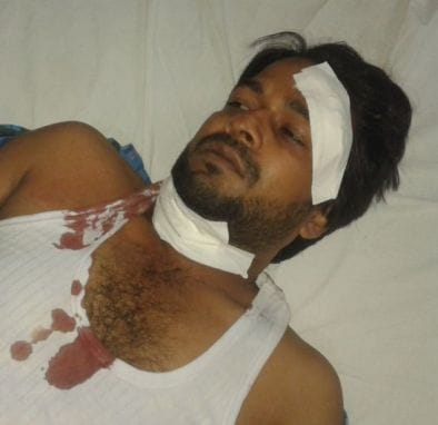 Five injured in road accidents, one in critical condition