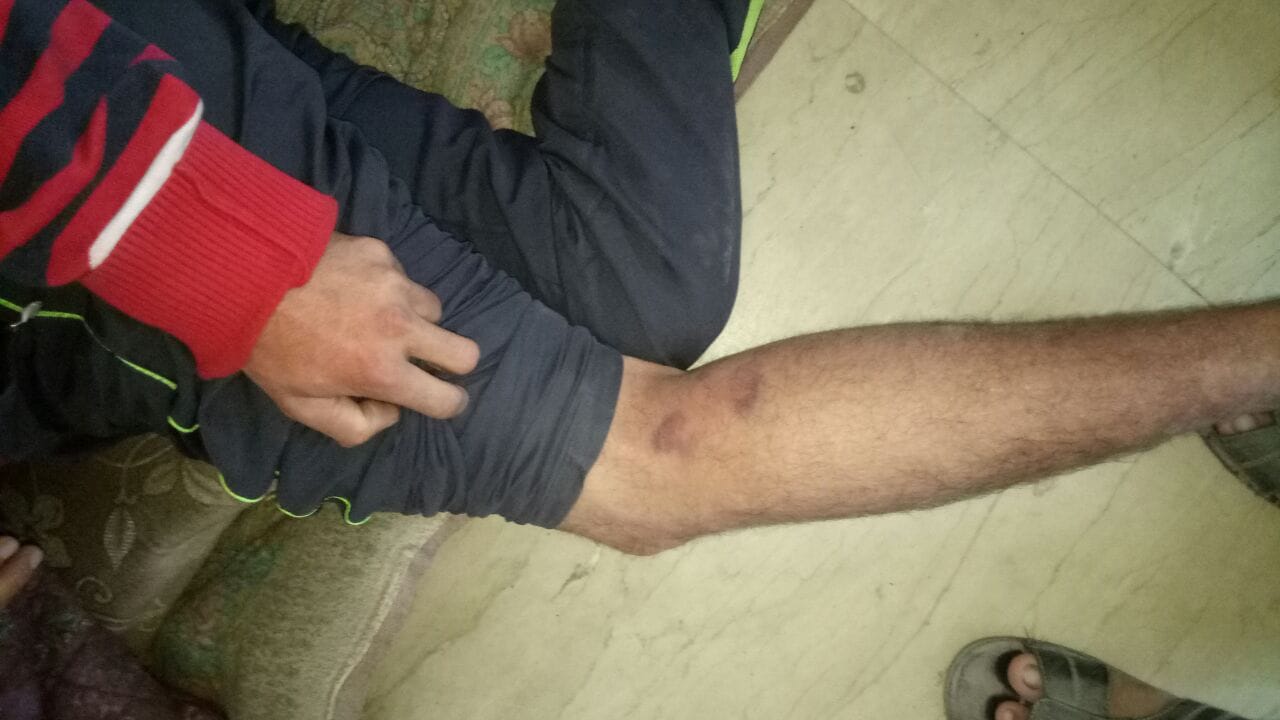 loot on petrol pump in vikasnagar.
