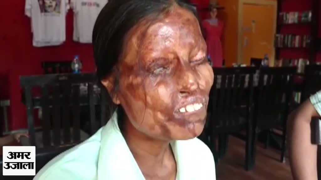 Agra Acid Attack Survivor Mother-daughter Story Screened At Melbourne Film Festival