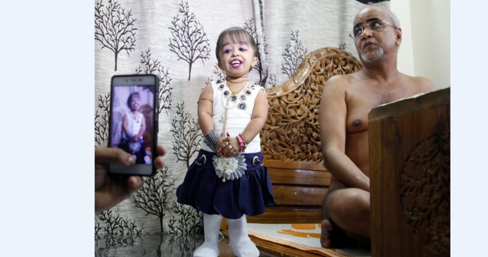 Jyoti Amge is in chandigarh, talk on beti bachao beti padhao