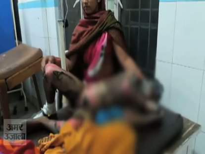 The fire scorched the entire family