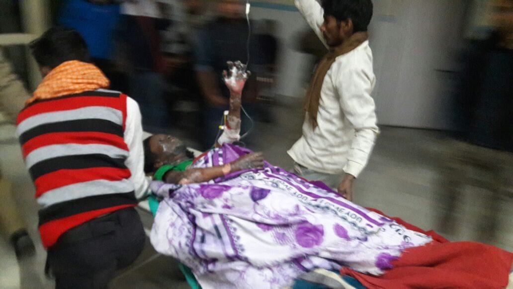along three child five men burn in dehradun.