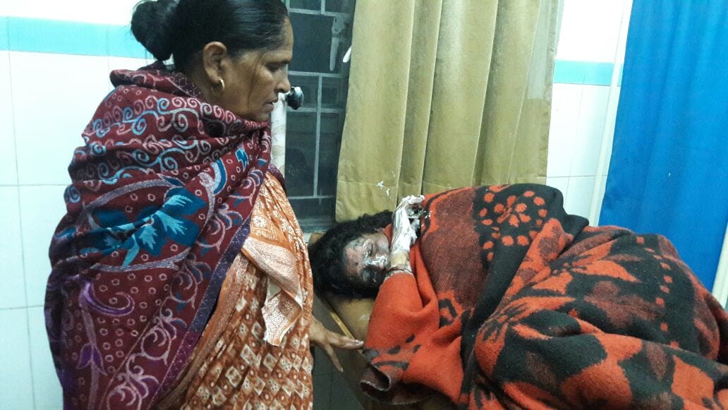 along three child five men burn in dehradun.