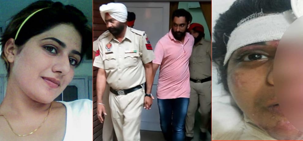 The real truth of the acid attack case, acid, wife's life became hell, 4 got life prison