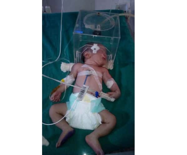People throw new born girl child on roads.