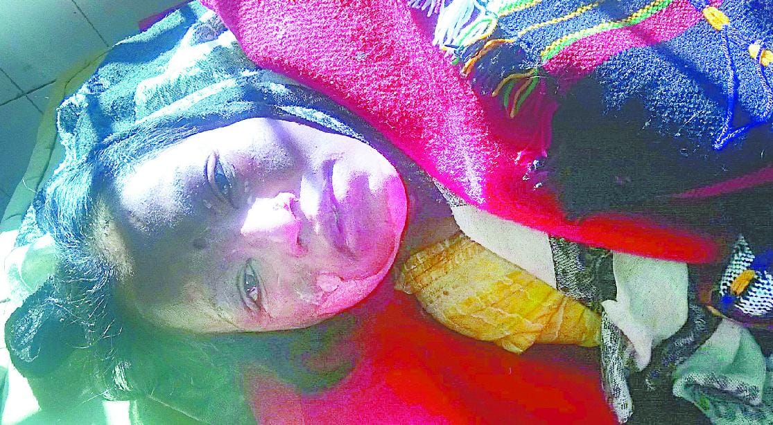 Mahalakshmi Puja wife burned before