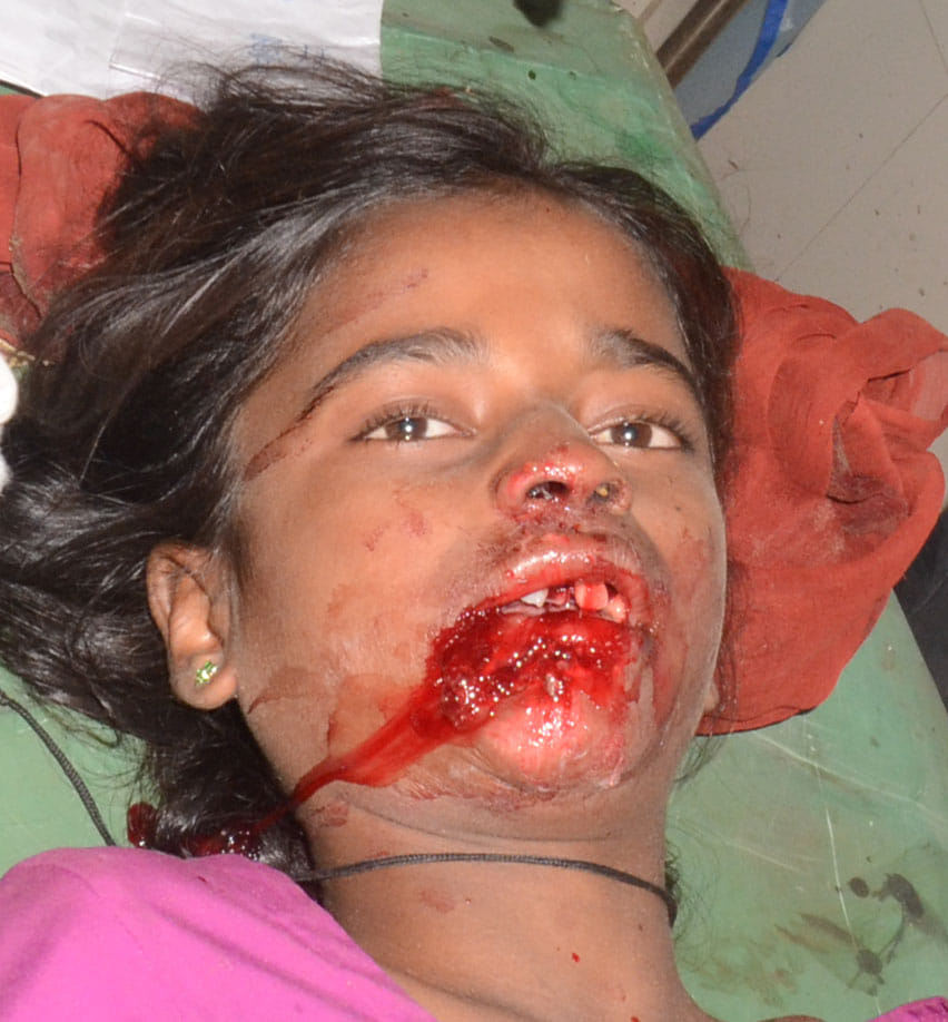 The girl died in the accident, including two 