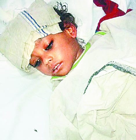 High fever taken the lives of teens