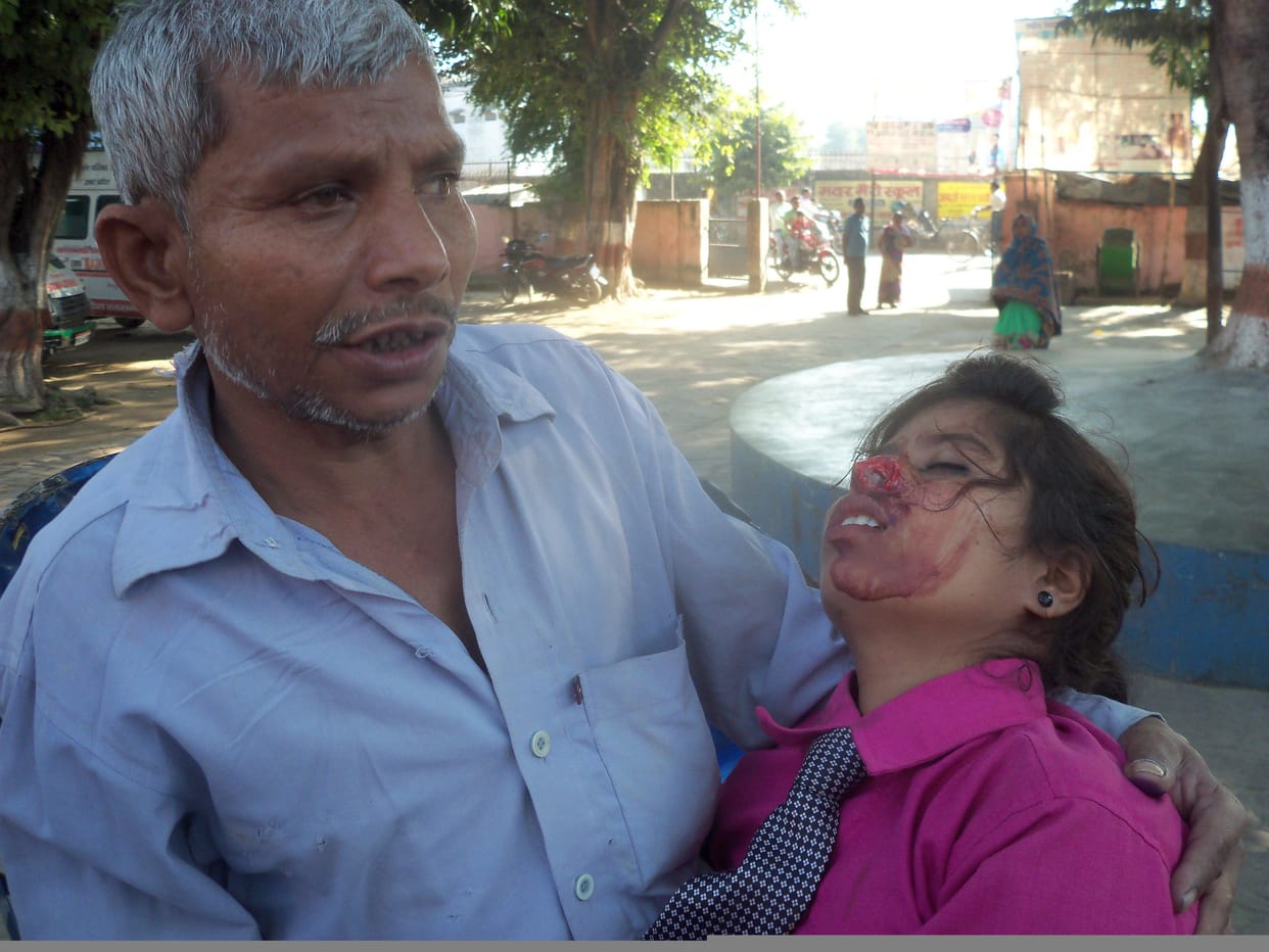 Wife husband's nose cut He surrendered to police station