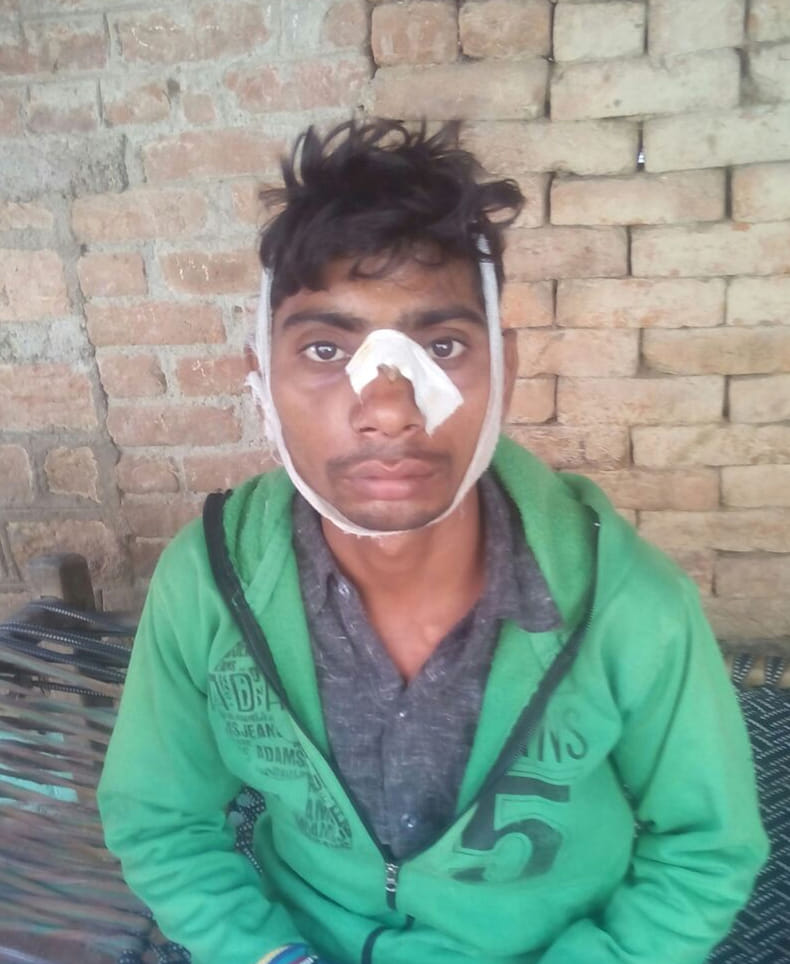 after court marriage violence, 16 injured in stone pelting-beating