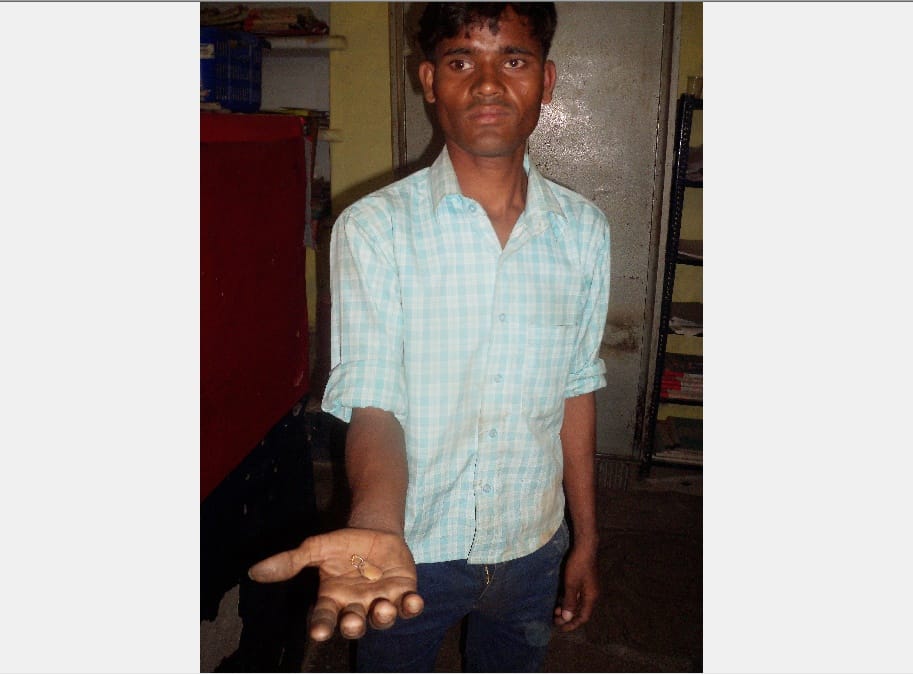 husband cut off wife's nose and surrender to the police station