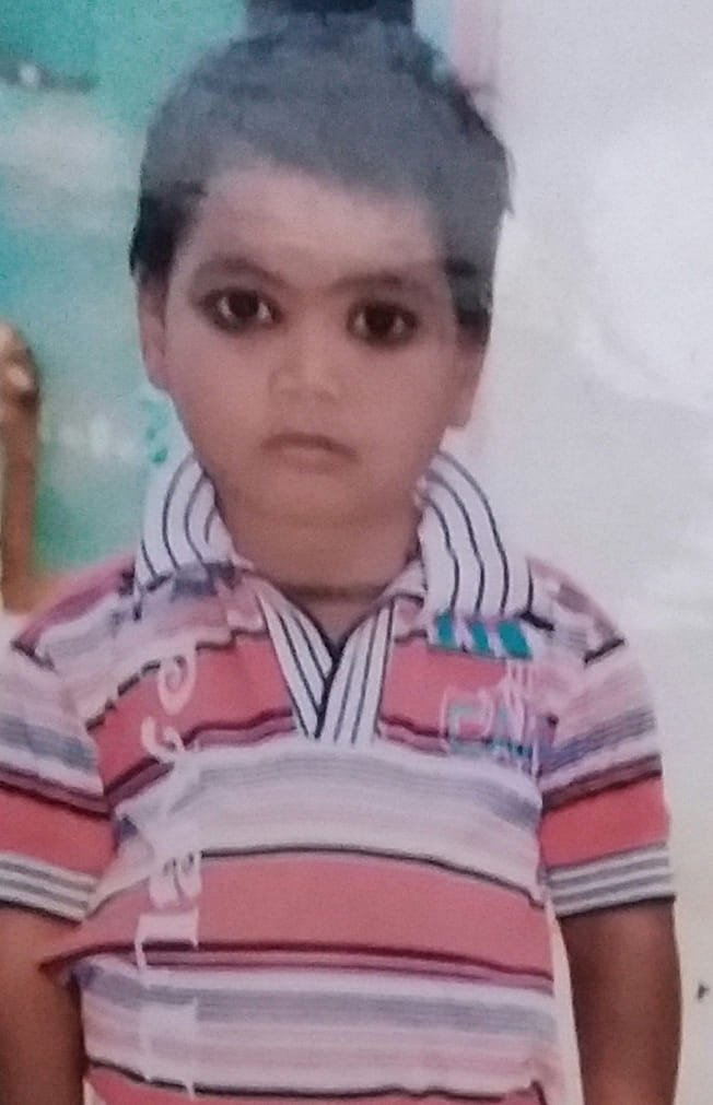 two boy burnt, dead