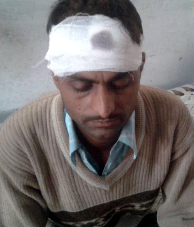 Home Guard beaten.