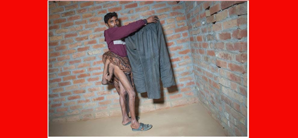 man with four limbs goes viral on social media when asked for help, delhi hospital came forward