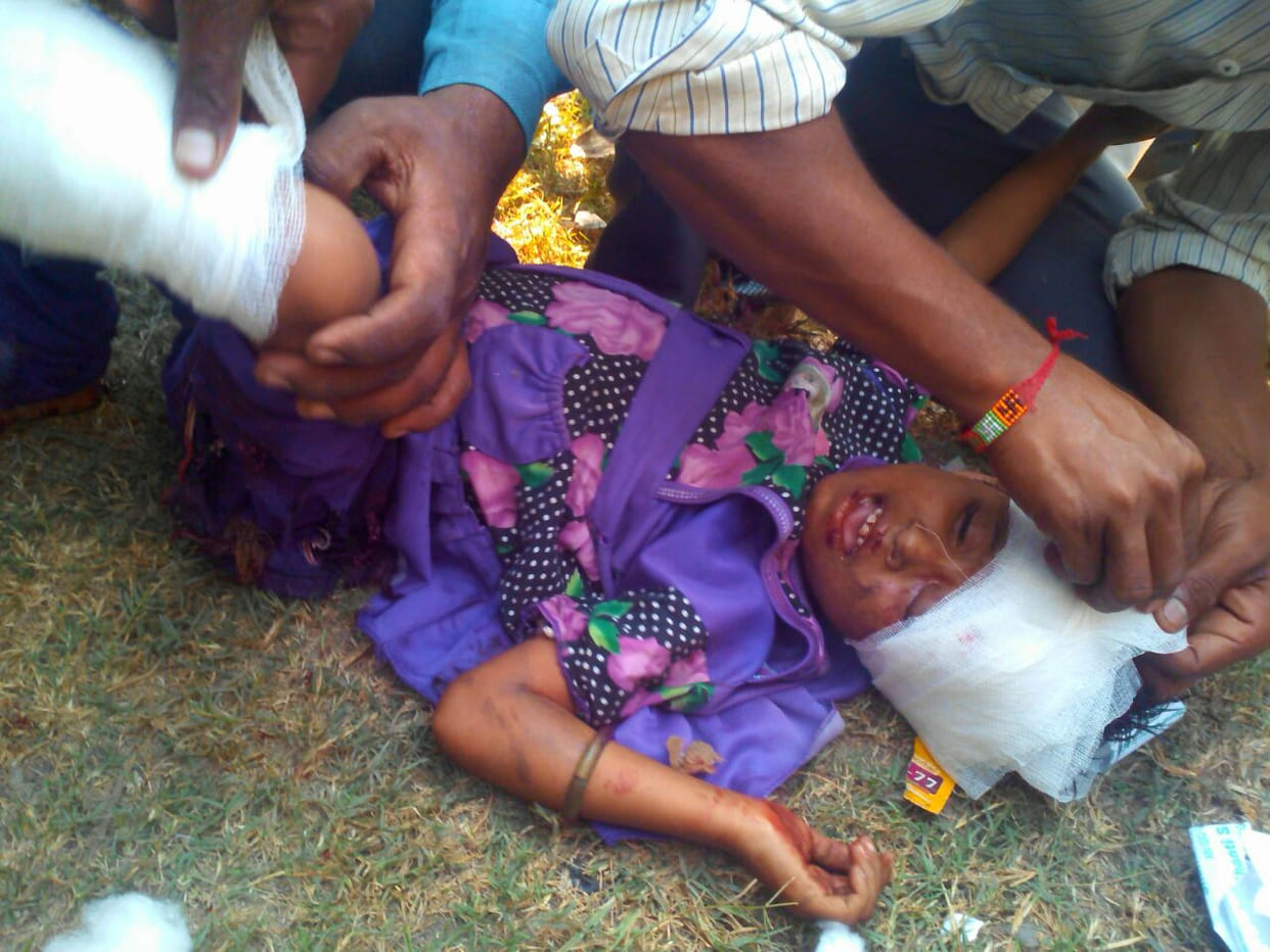 Woman killed by train slip, child injured