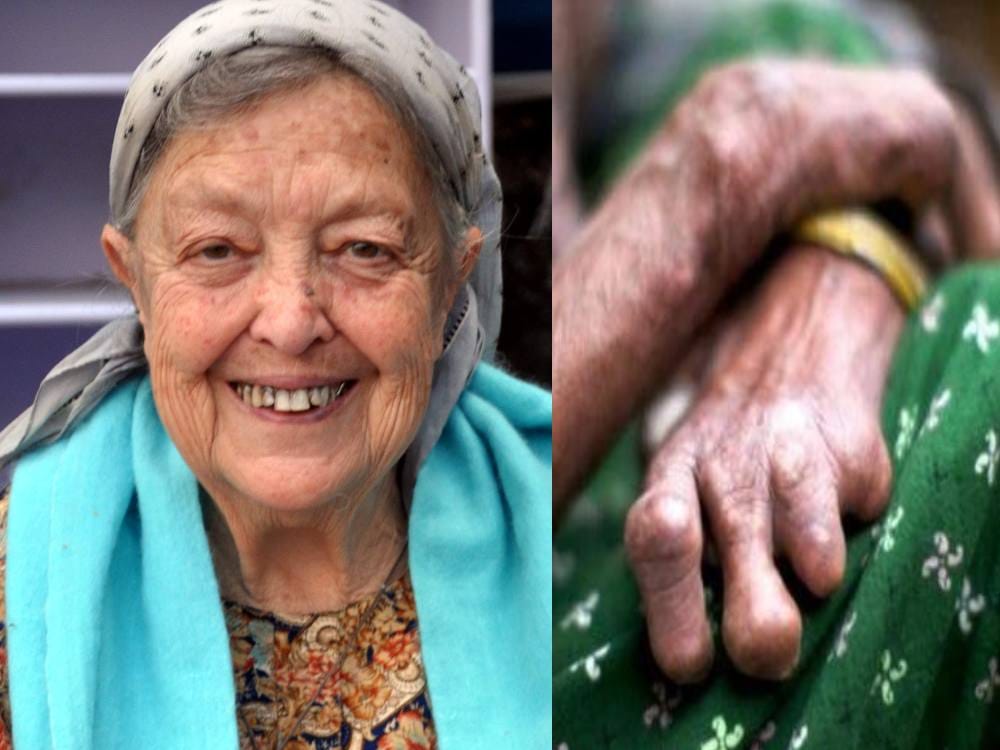 italy juana serves leprosy patients