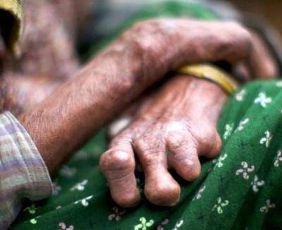 italy juana serves leprosy patients