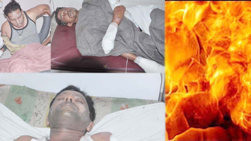 fire in hotel, three scorched