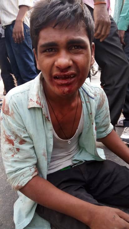 मेडिकल कॉलेज में तीमारदार की हुई थी पिटाई।