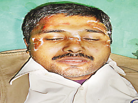 njured Factory worker ibike rider vehicle collision