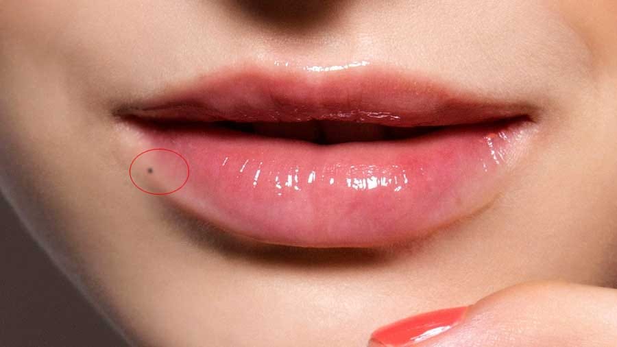 mole on body meaning money problem