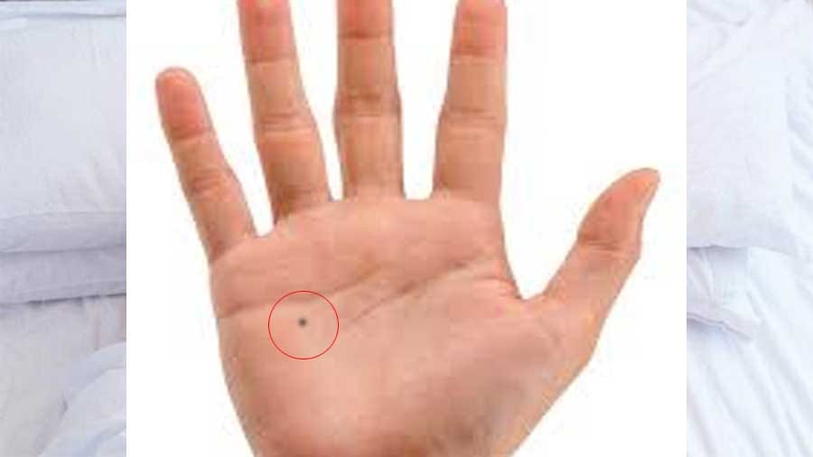 mole on body meaning money problem