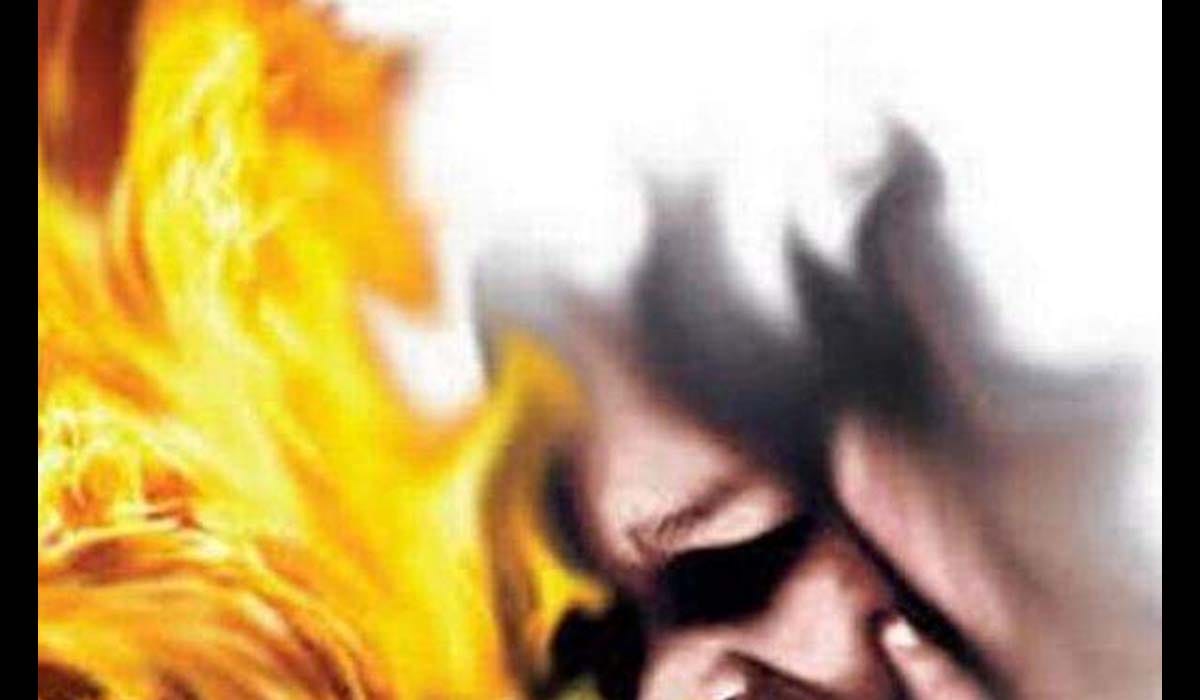 Burnt alive young woman