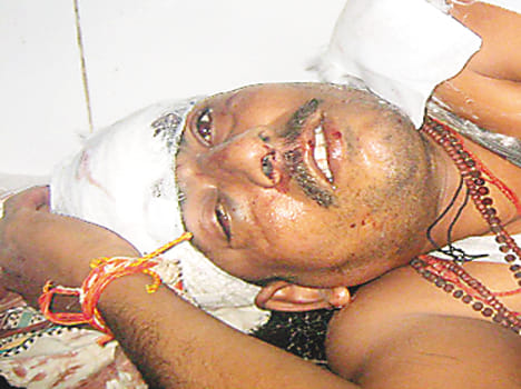 Bike riders killed by car collision