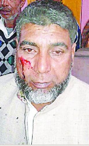 Troॅli attack spoke on removal dispute