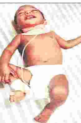 bacche kuposhit