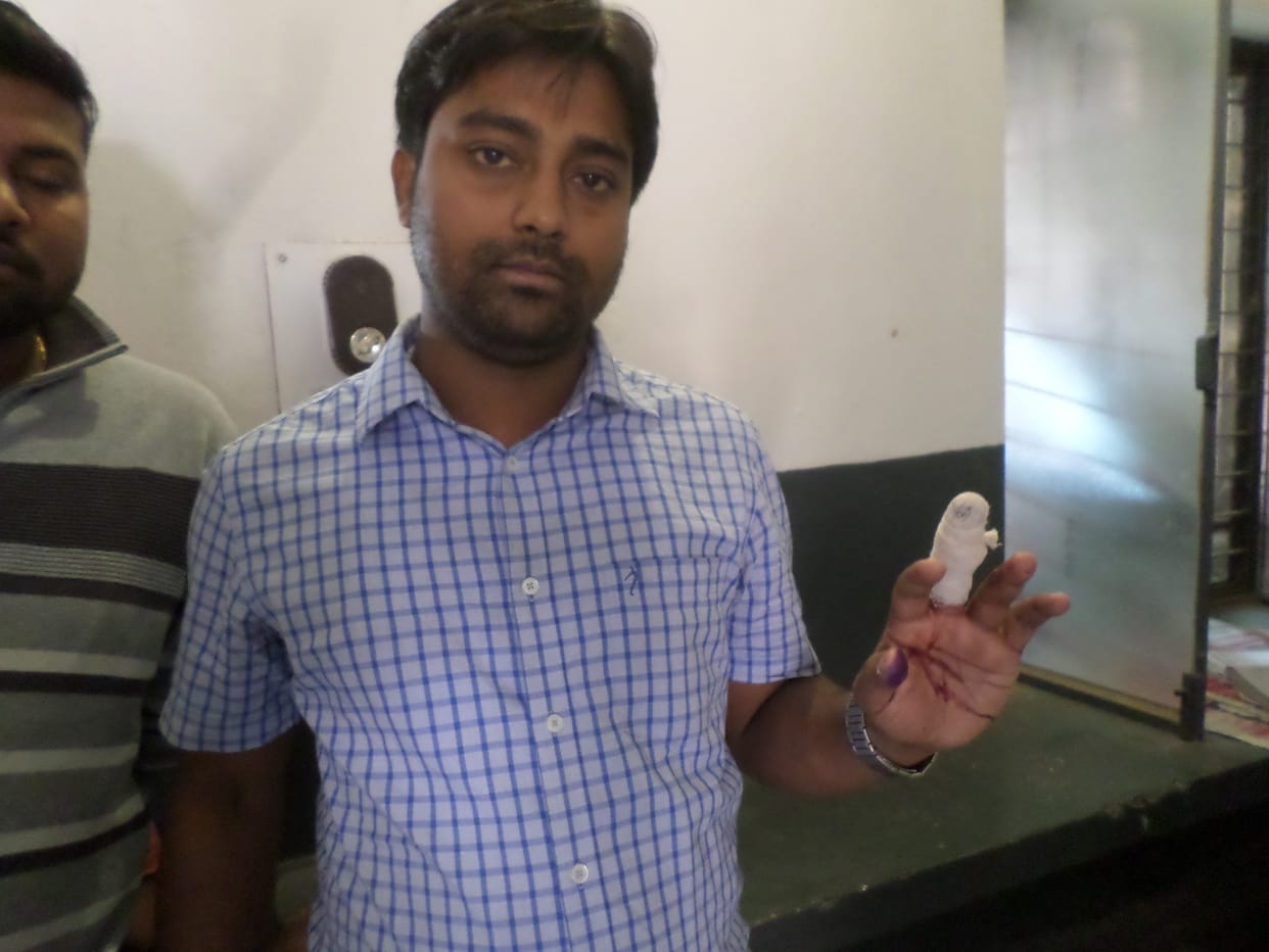 The bank manager to change the cut off finger