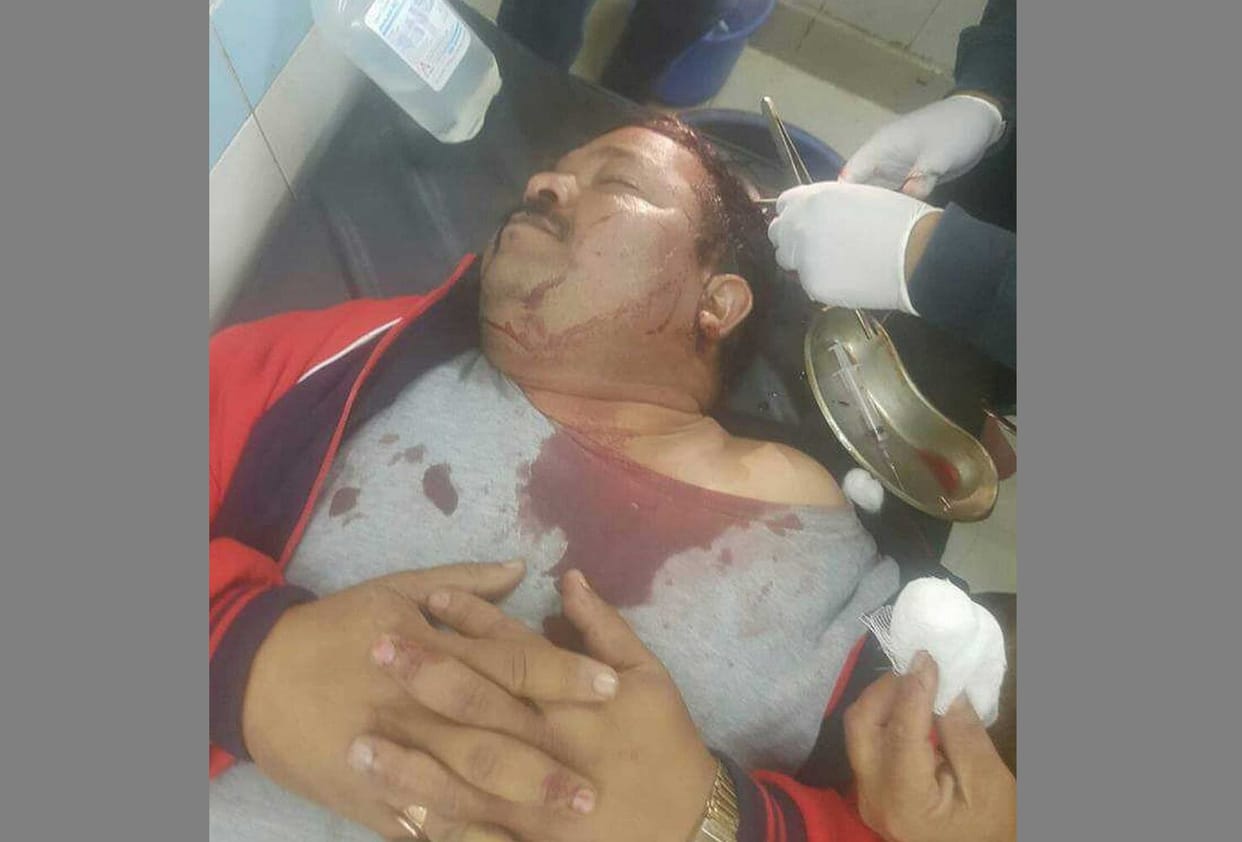 journalist beaten up in ramnagar.