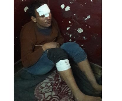 police team attacked in Lucknow.