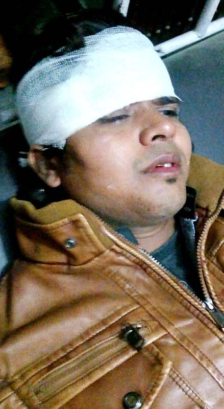 four wounded in magic accident