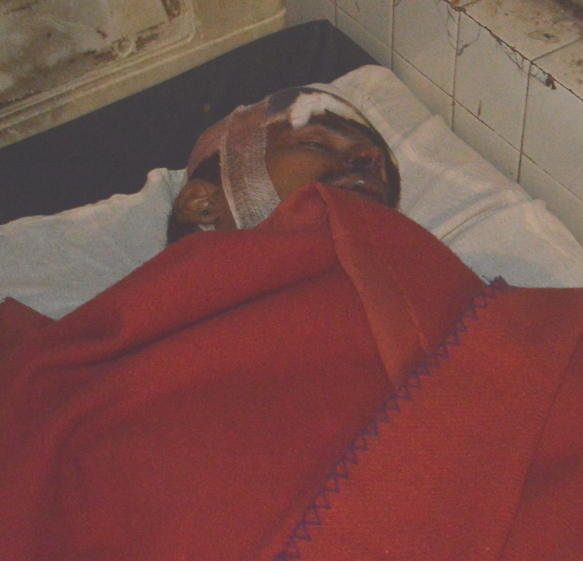 Young man's leg severed in the accident