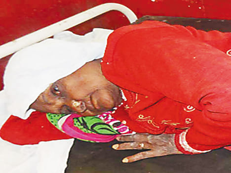 Old woman was injured