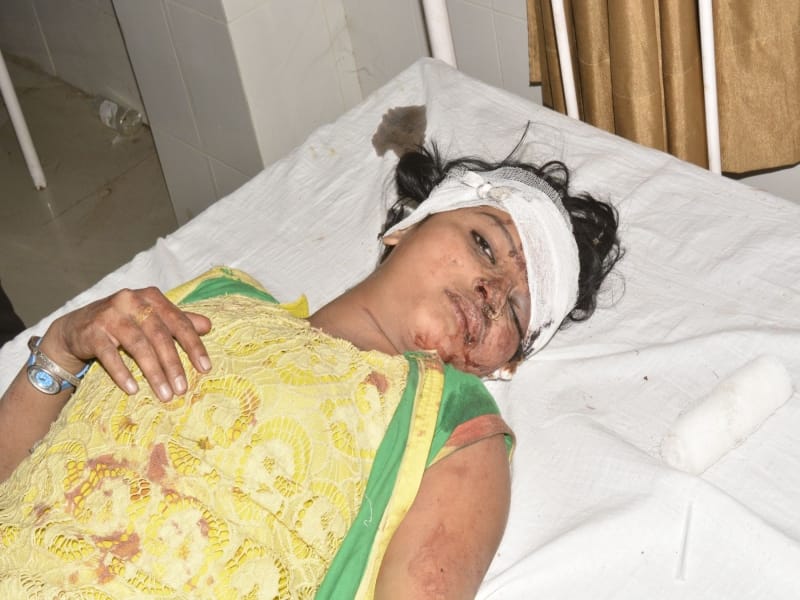 17 injured in an accident in mathura