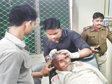 Train to be vulnerable to old injuries, death