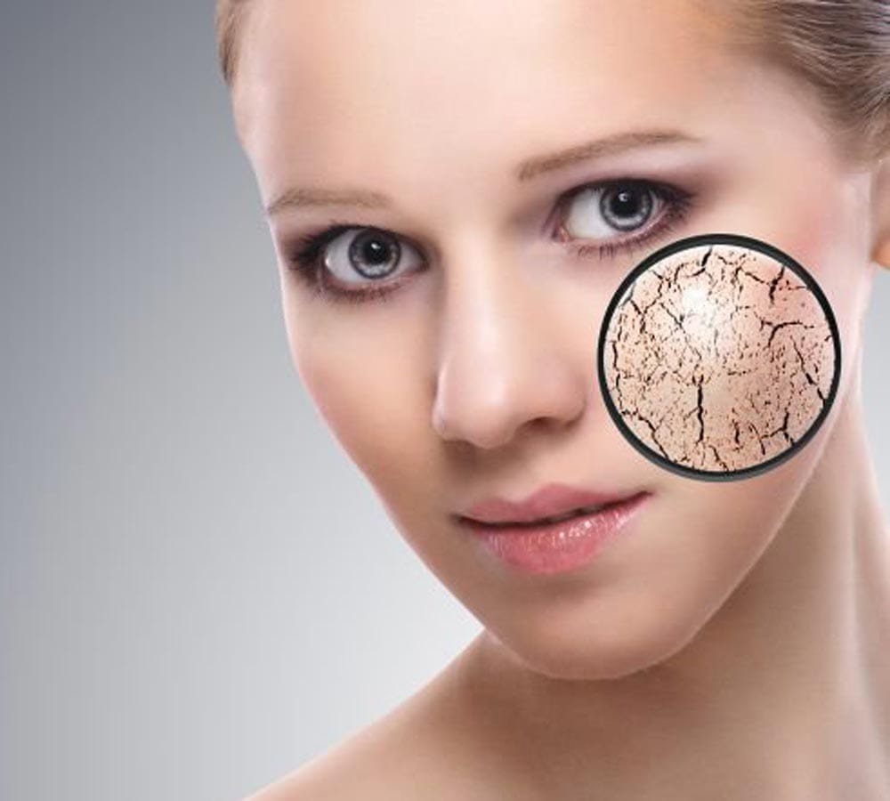  say bye bye to itching problem
