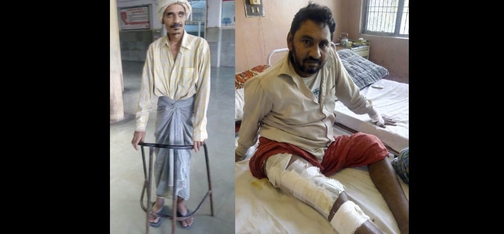 hip transplant by al afia hospital doctors