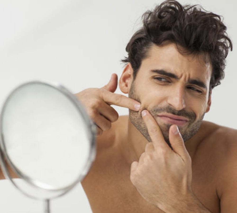 home remedy to get rid of acne