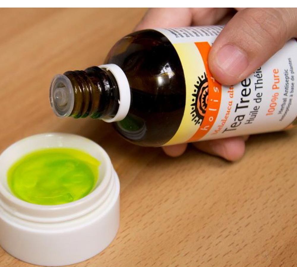 home remedy to get rid of acne